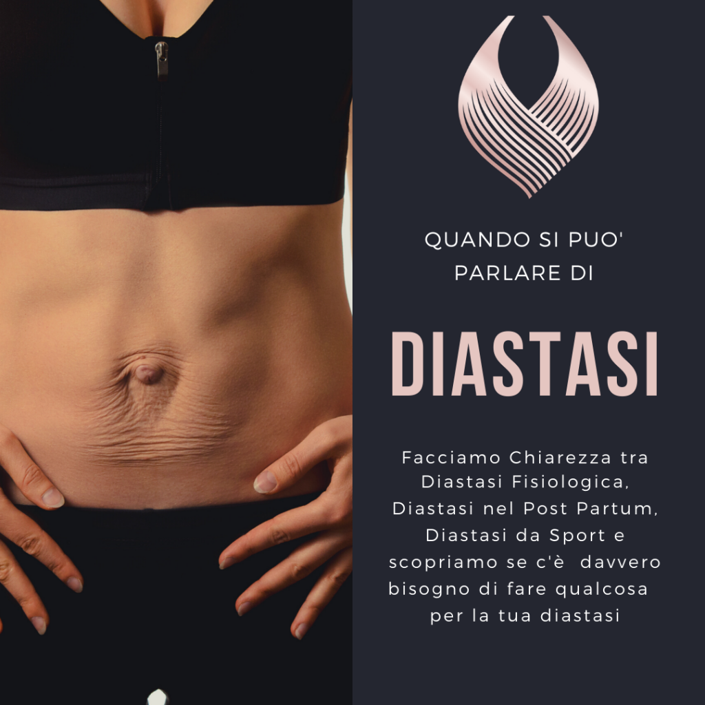 copertina di anteprima per un articolo che tratta di quando è possibile parlare di diastasi addominale