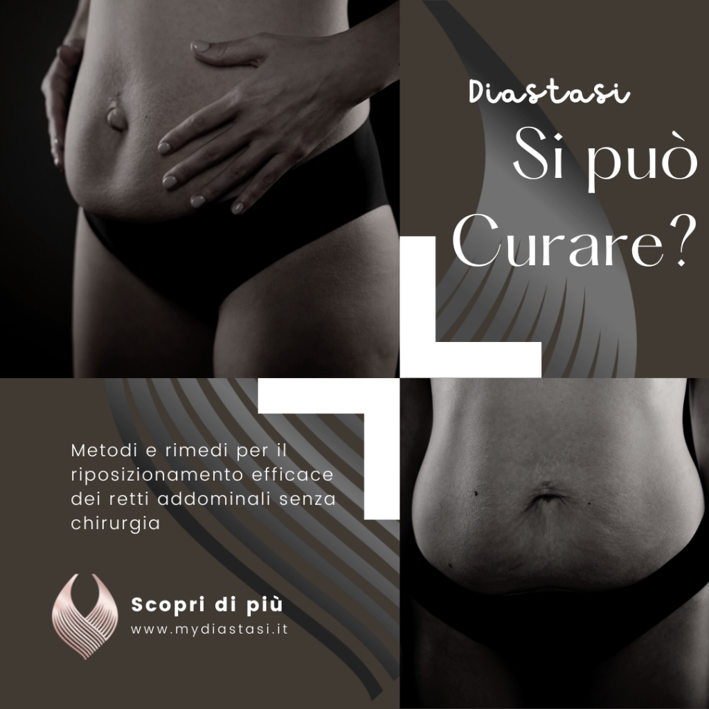 copertina di anteprima per un articolo sui metodi e rimedi per curare la diastasi addominale